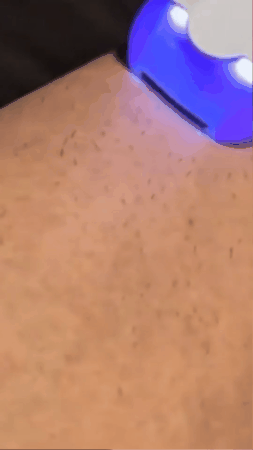 Depiladora Yes Depilador De Cuerpo